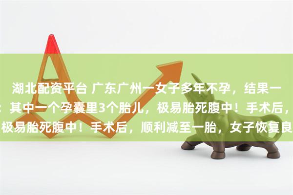 湖北配资平台 广东广州一女子多年不孕，结果一次性怀上四胞胎，医生：其中一个孕囊里3个胎儿，极易胎死腹中！手术后，顺利减至一胎，女子恢复良好